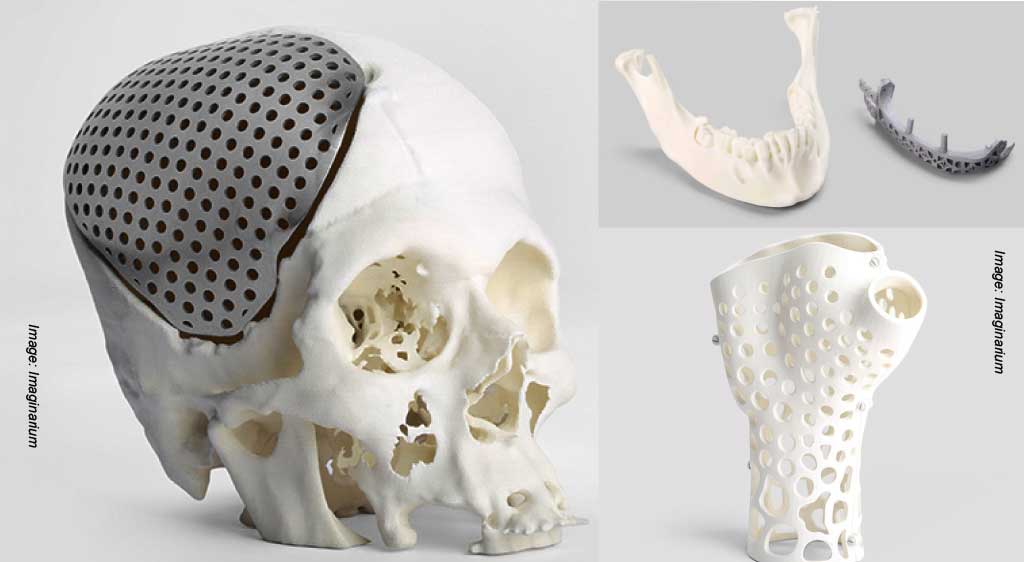 Sukkerrør Forbigående Ekspert How 3D Printing changing the medical field | OEM UPDATE 