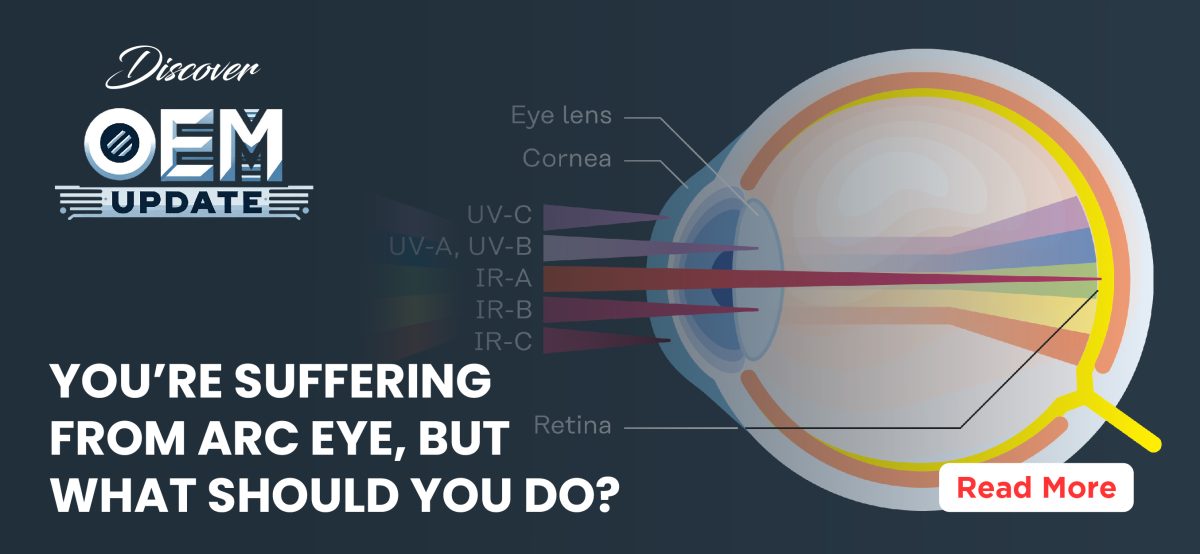 You’re suffering from arc eye, but what should you do?
